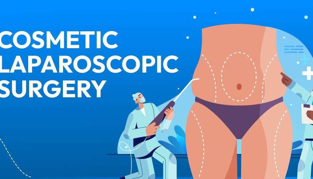 Cosmetic-Laproscopic-Surgery