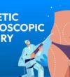 Cosmetic-Laproscopic-Surgery