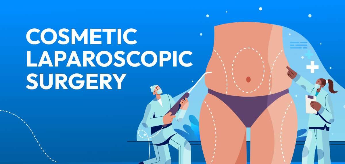 Cosmetic-Laproscopic-Surgery
