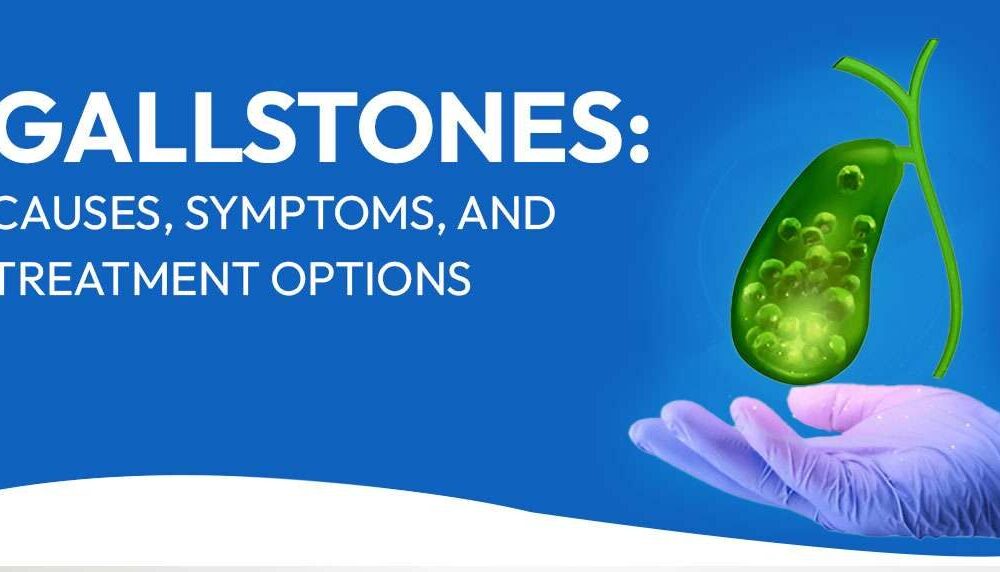 Gallstones-Causes-Symptoms-and-Treatment-Options