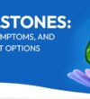 Gallstones-Causes-Symptoms-and-Treatment-Options