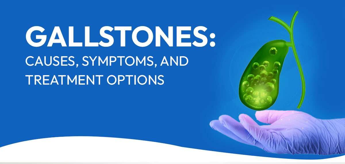 Gallstones-Causes-Symptoms-and-Treatment-Options